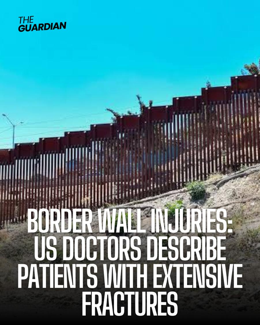 California physicians say the rising number of patients have 'fractures all over their body' after falls from the wall 'like a three-story building.'